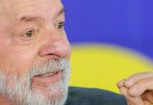 Lula tem recuperação satisfatória após cirurgia de catarata no olho esquerdo