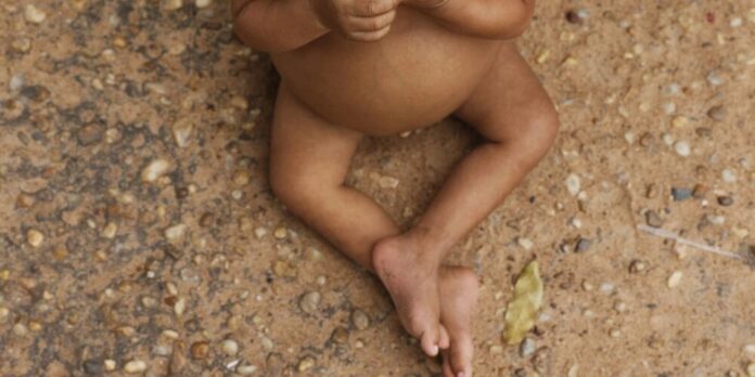 Vulnerabilidade social impacta altura de crianças indígenas e nordestinas, aponta pesquisa da Fiocruz